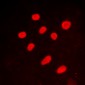 Anti-CTBP2 Antibody